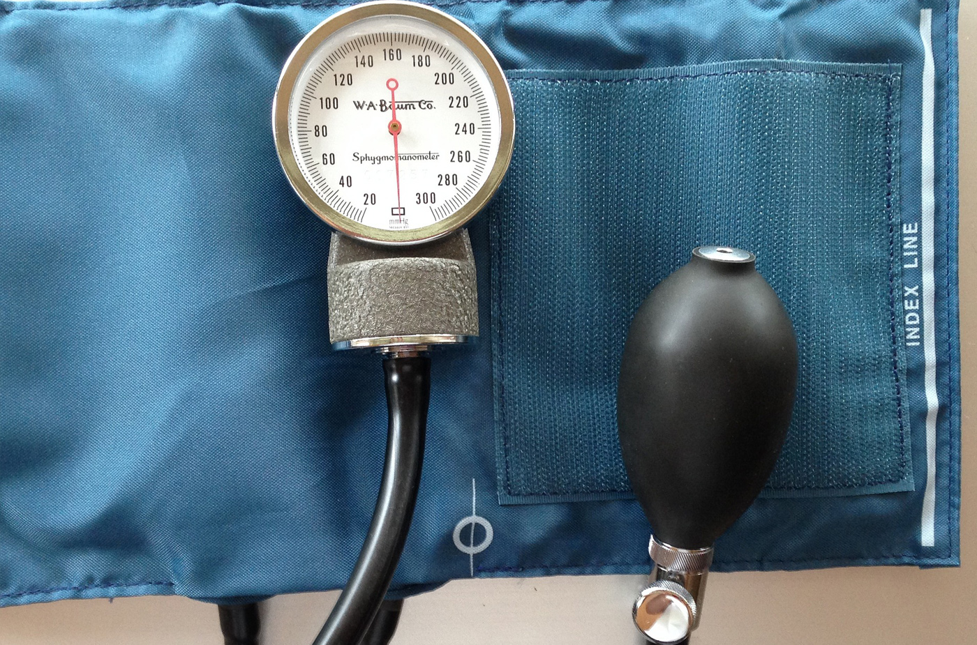Hypertension artérielle